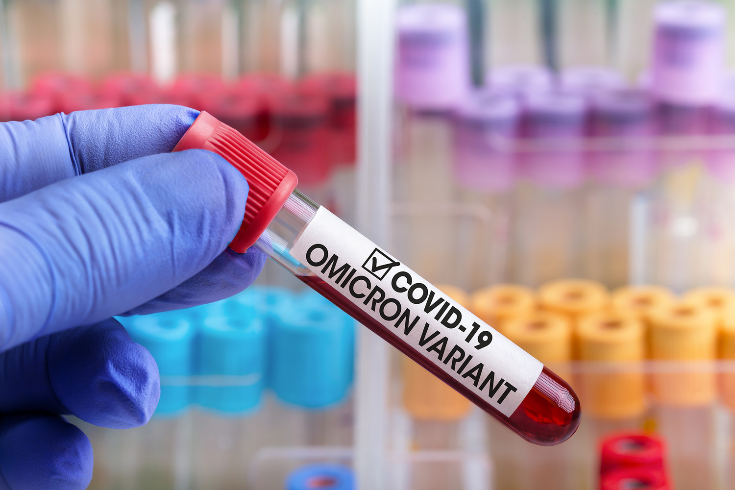 «Омикрон» выявляют у привитых – результаты исследования нового штамма коронавируса