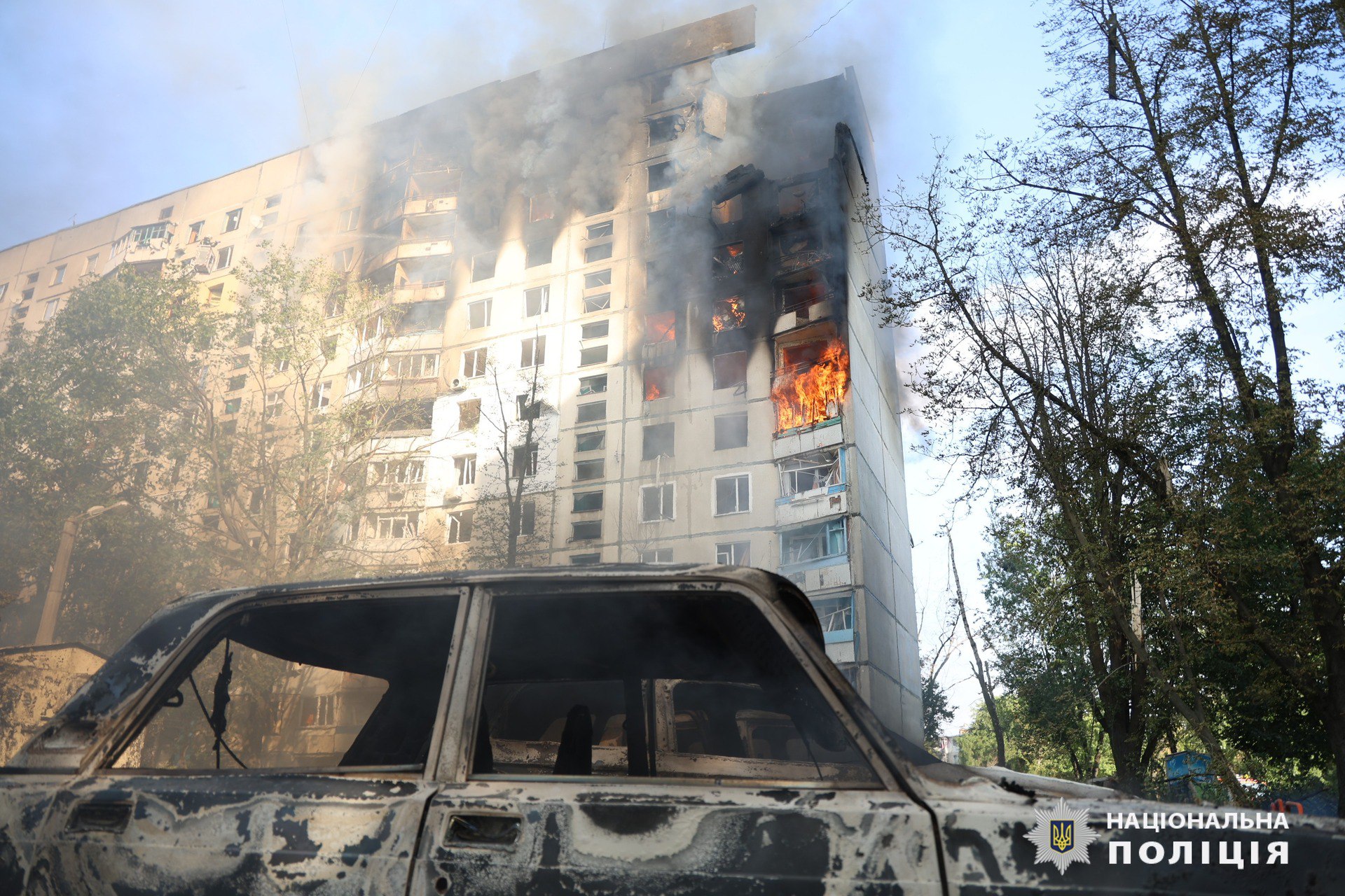 Масовані обстріли Харкова: лікарі розповіли про стан поранених, що залишаються в лікарні